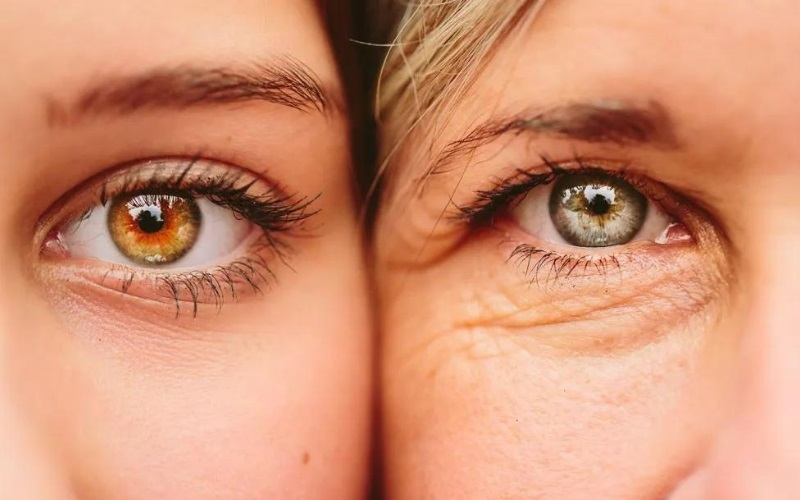 Under-Eye